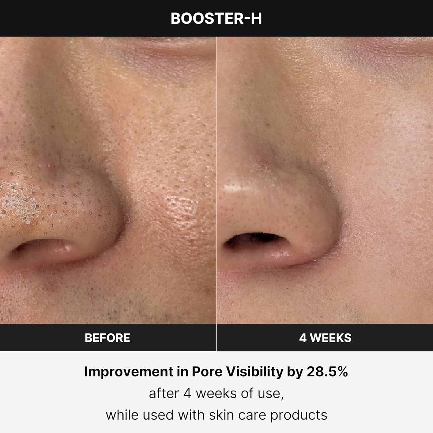 Medicube Booster H in Your Skincare Rout - Image 6