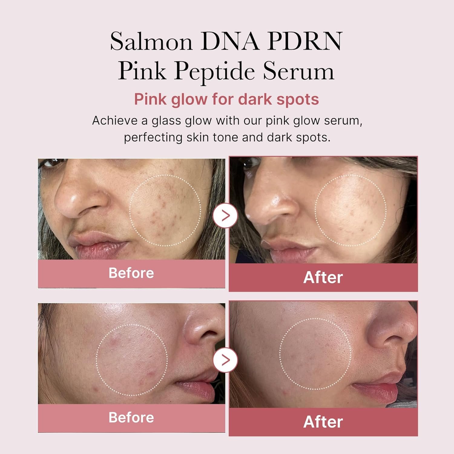 Medicube Salmon DNA PDRN Pink Peptide Serum - Image 3